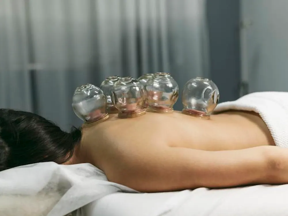 Cupping Therapy at HealthSource of Harvest in Harvest