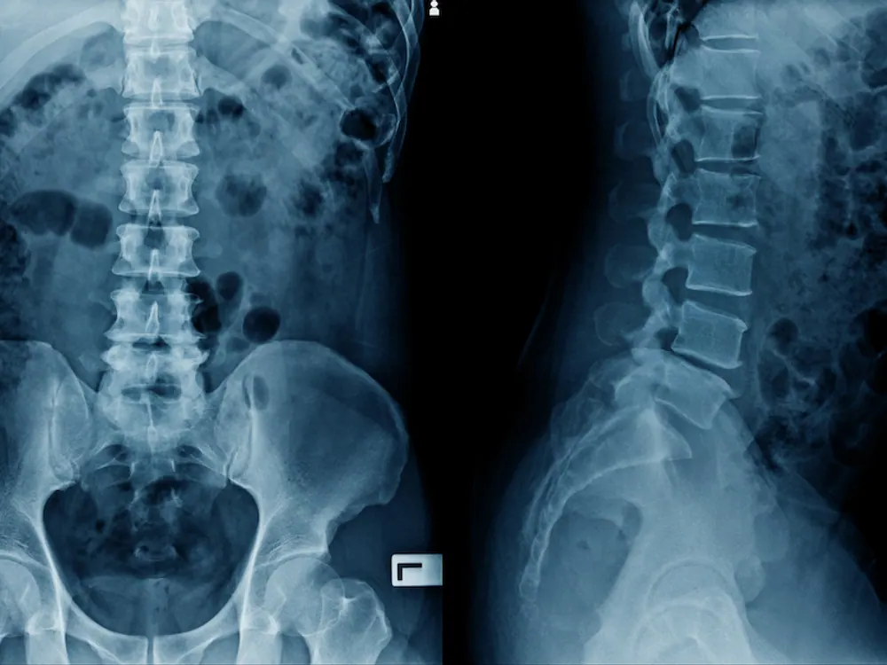 X-Rays at HealthSource of Harvest in Harvest