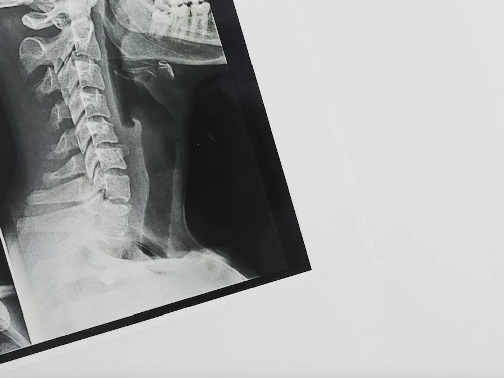 How X-Rays works at HealthSource of Harvest