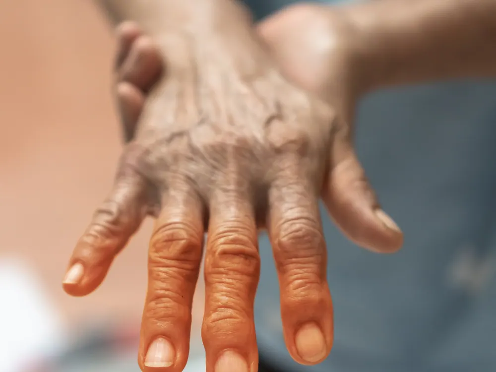 How HealthSource of Harvest treats neuropathy in Harvest