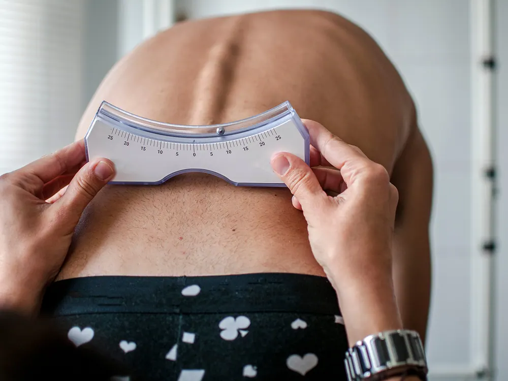 How HealthSource of Harvest treats scoliosis in Harvest
